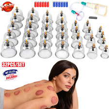 32x Cupping Vacuum Massage Cups Set Therapy Health Acupuncture Suction Magnet