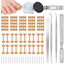 Ingrown Toenail Corrector Set with Correction Strips, Professional Ingrown Toena