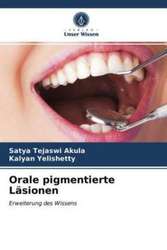 Thumbnail - Orale Pigmentierte Läsionen Erweiterung Des Wissens 6554