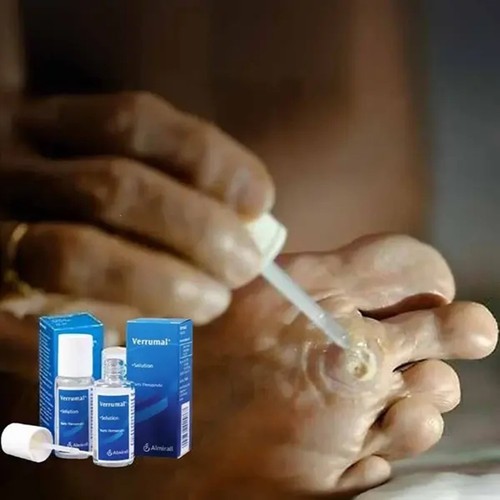 VERRUMAL Lösung 13ml Entfernen Warzen & Hühneraugen Therapeutisch Almirall Kostenloser Versand - Bild 7 von 7