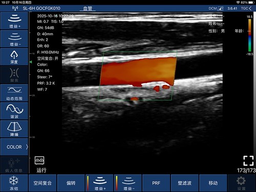 Doppler a colori lineare palmo portatile scanner a ultrasuoni sistema di imaging portatile - Foto 5 di 5