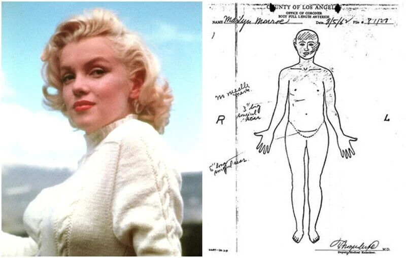 Marilyn Monroe Autopsy Secrets Exposed By Deputy Coroner!