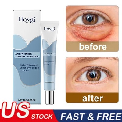 Under Eye Cream Remove Dark Circles Bags Face Lines Ageless Wrinkles Puffy Eye-