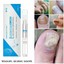 thumbnail 4 - Nail Fungal Treatment Pen Anti Fungus Infection Biological Repairs Solution Care