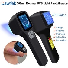 308nm UVB Handheld Ultraviolet Light Therapy for Skin Disease Self Care at Home