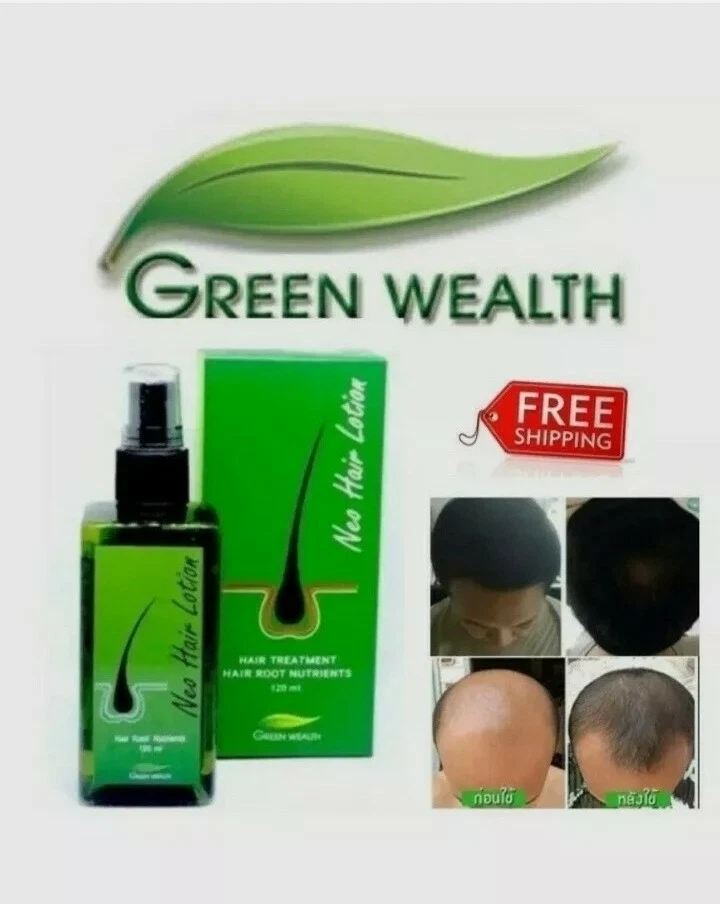 Neo Hair Lotion 120ml, 100% Original Authentic MFG: 22/01/2025