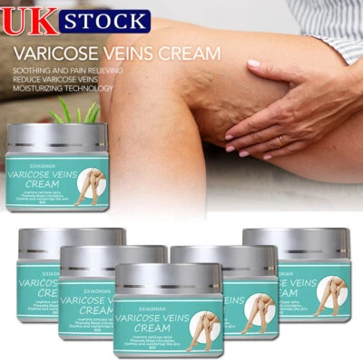 SXIAGNIAN Varicose Veins Miracle Ointment Cream Gel Veinhealing Varicose Treatment Spray