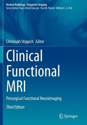 Clinical Functional MRI - 9783030833459