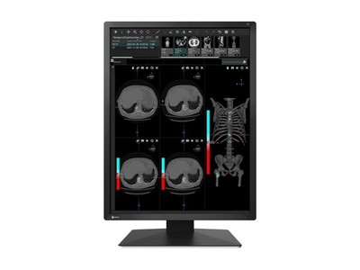 Eizo MX217BK 21.3in LCD LED Color Monitor DICOM Black