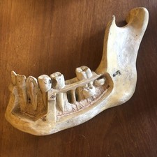 Antique 19th Century Model Of A Jaw With Teeth Teaching Aid