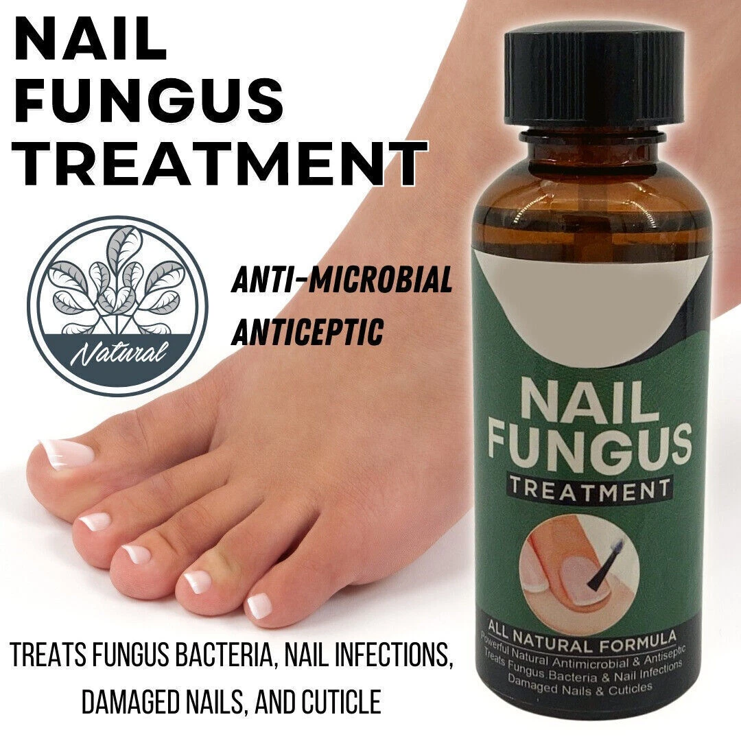 Nail fungus natural remedy deals