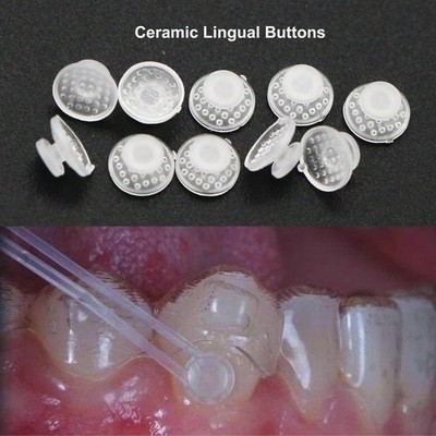 US 100Pcs Orthodontic Dental Ceramic Lingual Button Bondable Round Base Clear