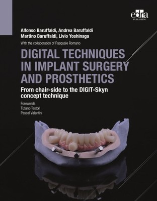 Digital Techniques In Implant Surgery by Alfonso Baruffaldi, MD, DDS HARDBACK