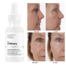 The Ordinary Hyaluronic Acid 2% + B5 Serum | 1 fl oz