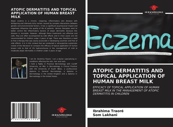 Atopic Dermatitis And Topical Application Of Human Breast Milk Ibrahima Traoré-image
