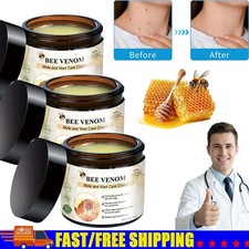 Bee Venom Skin Tag Removal Treatment Cream Body Care Mole Corn Wart Remover