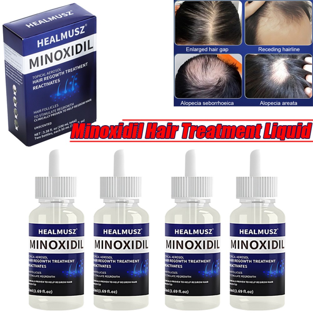 2/4PCS Minoxidil 5% Topical Solution Hair Regrowth Anti-Loss Treatment Essence
