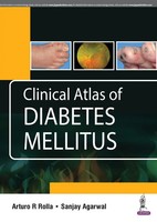 Clinical Atlas Of Diabetes Mellitus | Arturo R Rolla (U. A.) | Taschenbuch