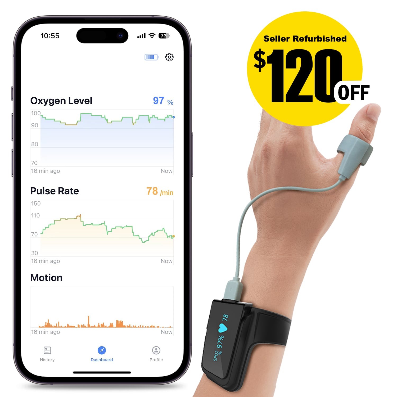 Checkme O2 Max with O2 Ring Probe Continuous Pulse Oximeter Heart Rate Monitor