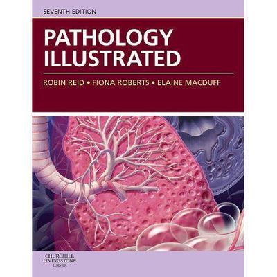Pathology Illustrated by Dr. Robin Reid