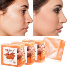 Turmeric Face Serum Oil Tumeric Soap Whitening Ance blemish Corrector Dark Spots