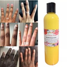 FAST ACTION DARK KNUCKLE ERASER /FEET/ELBOW LOTION CLEAR EVEN-TONE, 7Days 6oz  