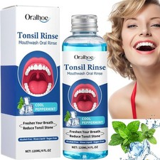ORALHOE Natural Tonsil Stone Remover Rinse Mouthwash &Bad Breath Treatment 120ml
