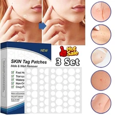 432Pcs Skin Tag Remover Patches Quick Effective Mole Wart Removal Pad Sticker US