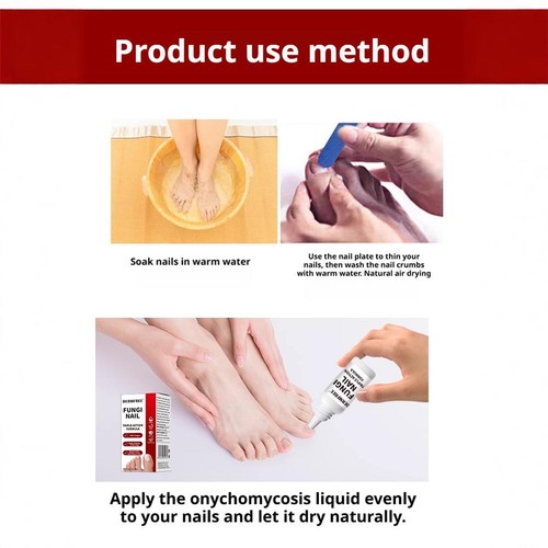 DERMFREE Fungi Nail Treatment - Triple Action Formula, Kills Fungus, 15mL - Picture 8 of 17