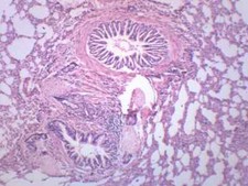 10PK Human Lung Section - Prepared Microscope Slides, 75x25mm - Eisco Labs