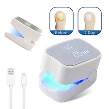 Laser Nail Fungus Treatment Device for Toenails  Fingernails Fast Results