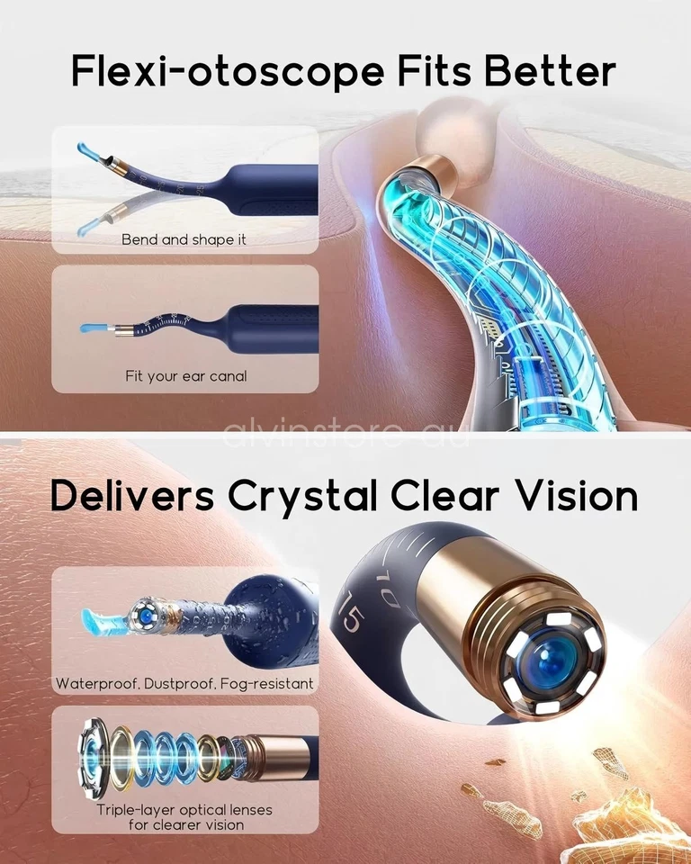 Bebird Ear Wax Removal Tool Earsight Plus Camera Ear Cleaner with Flexible - image 4 of 4