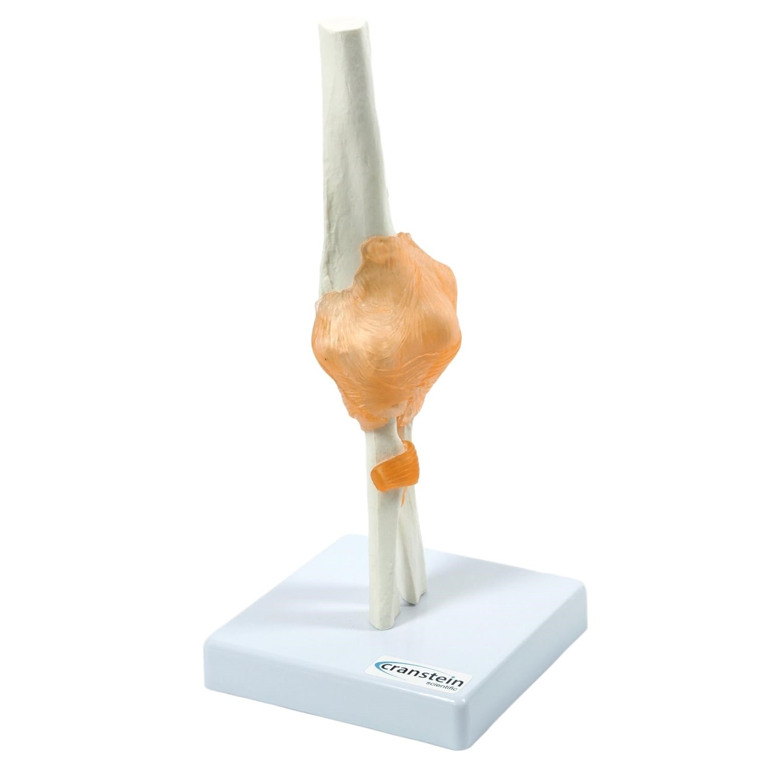 Ellbogen Anatomie Modell lebensgroß mit Ligamenten auf Stativ
