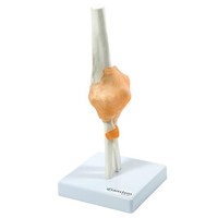 Ellbogen Anatomie Modell Lebensgroß Mit Ligamenten Auf Stativ