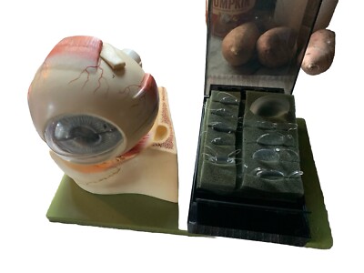Somso Vintage Eyeball with Part of Orbit, 3x Enlarged  Model w/ Intraocular Lens
