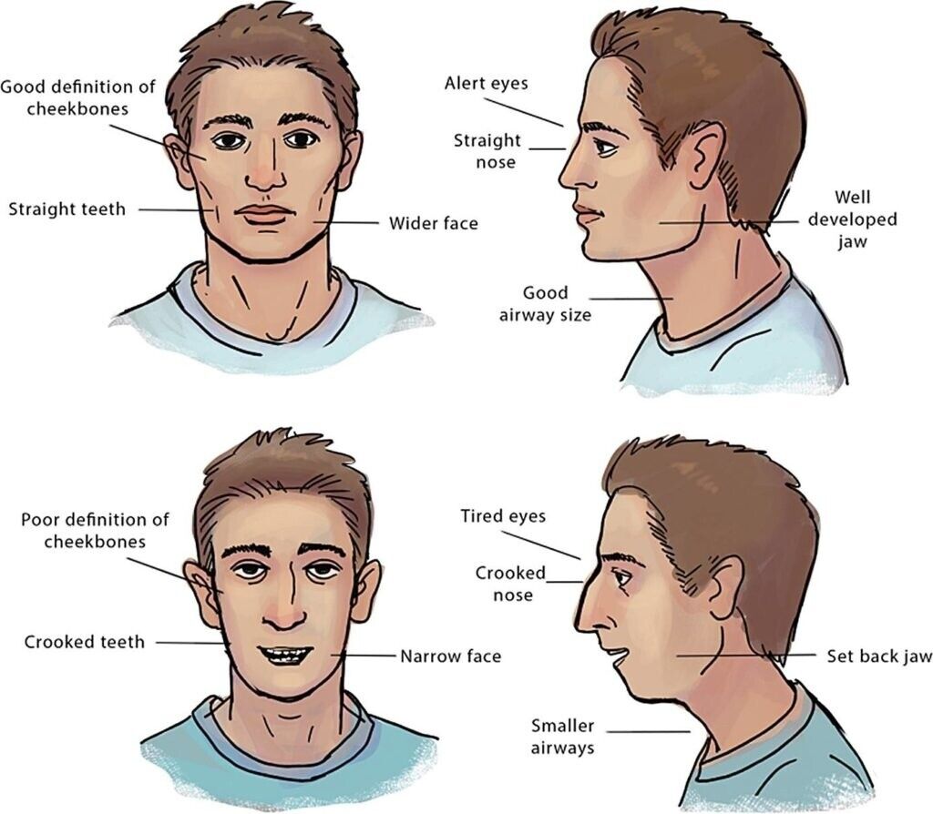 Mewing: Face & Chin Exercise 2.0 Free Download