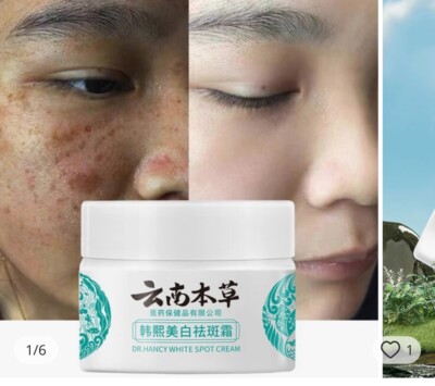 DR HANCY WHITE AGE DARK SPOT CREAM MOISTURIZER SKINCARE