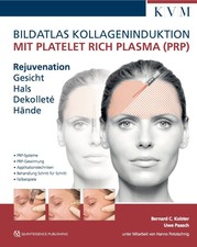 Bildatlas Kollageninduktion mit Platelet Rich...
