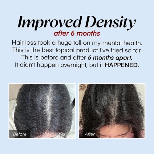 Scalpy Hair Growth Treatment Serum for Hair Loss and Thinning Hair | Cooling - Picture 3 of 9
