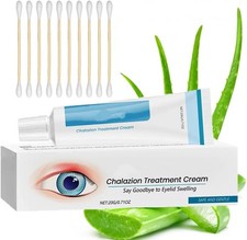 Blepharitis Treatment Eye Cream，Eyelid Cream For Blepharitis,Chalazion Remove