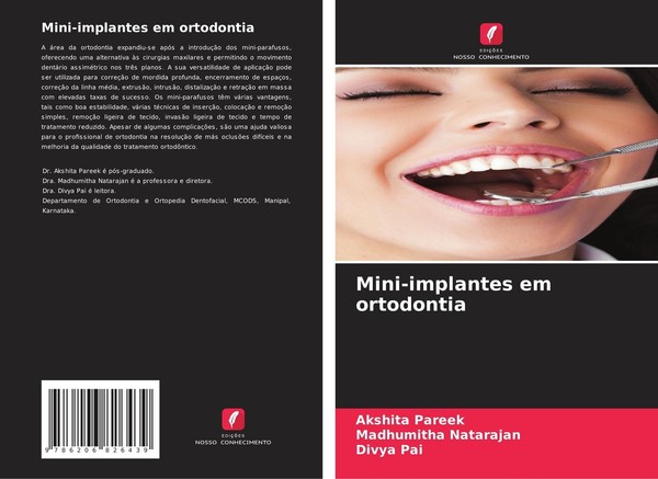 Mini-Implantes Em Ortodontia Madhumitha Natarajan-image
