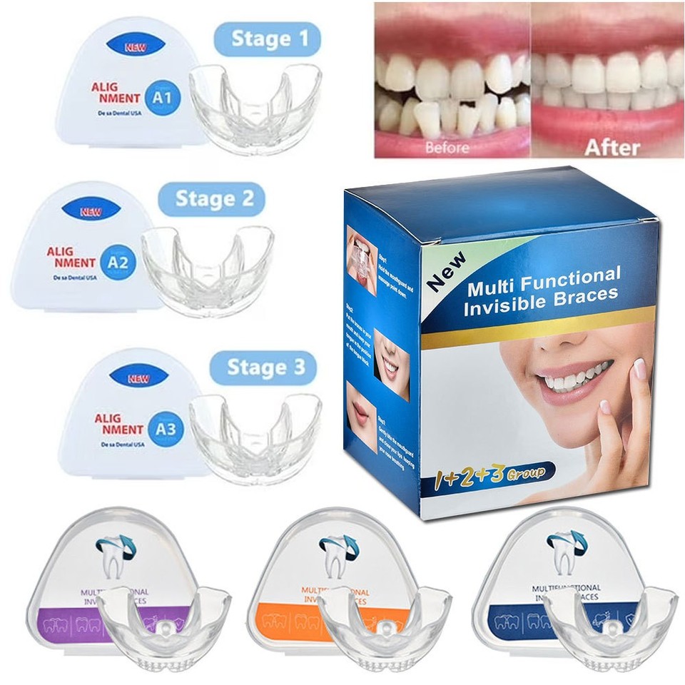 Gallery Detail: 3 Stage Dental Orthodontic Teeth Corrector Braces Tooth Retainer