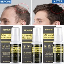 3 Pack 5 Minoxidil Hair Growth Serum Spray for Men Hair Regrowth 3 Month Supply