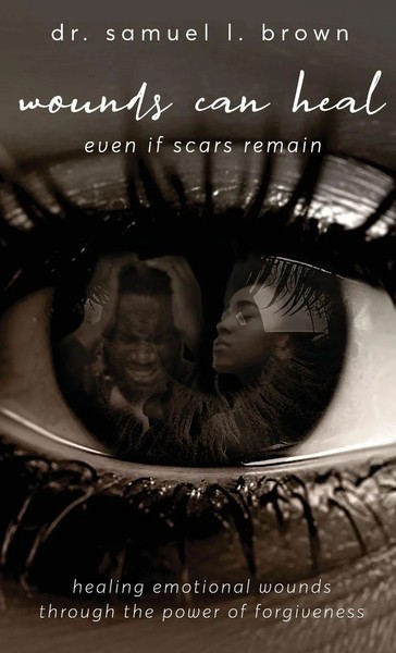Wounds Can Heal, Healing Emotional Wounds Through The Power Of Forgiveness-image