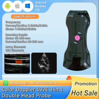 Portable 192-element color Doppler 3-in-1 wireless ultrasound scanner