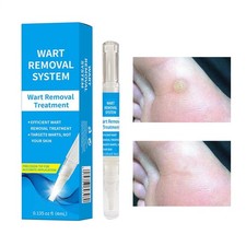 Wart Remover Pen Effective Treatment Of Warts Skin Tag Removal Pen For Body