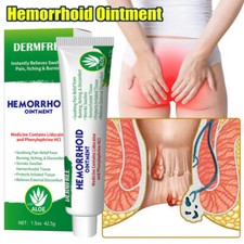 Hemorrhoids Remove Ointment Herbal Cream Relief Piles Pain Reduce Itching 42.5g
