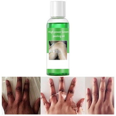 Peeling Oil for Dark Skin, Green Oil, Facial 3.52 Fl Oz (Pack of 1) 