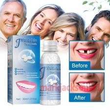 Strong Teeth Tooth Repair Permanent Dental Cement Cavity Filling Kit Fake Teeth