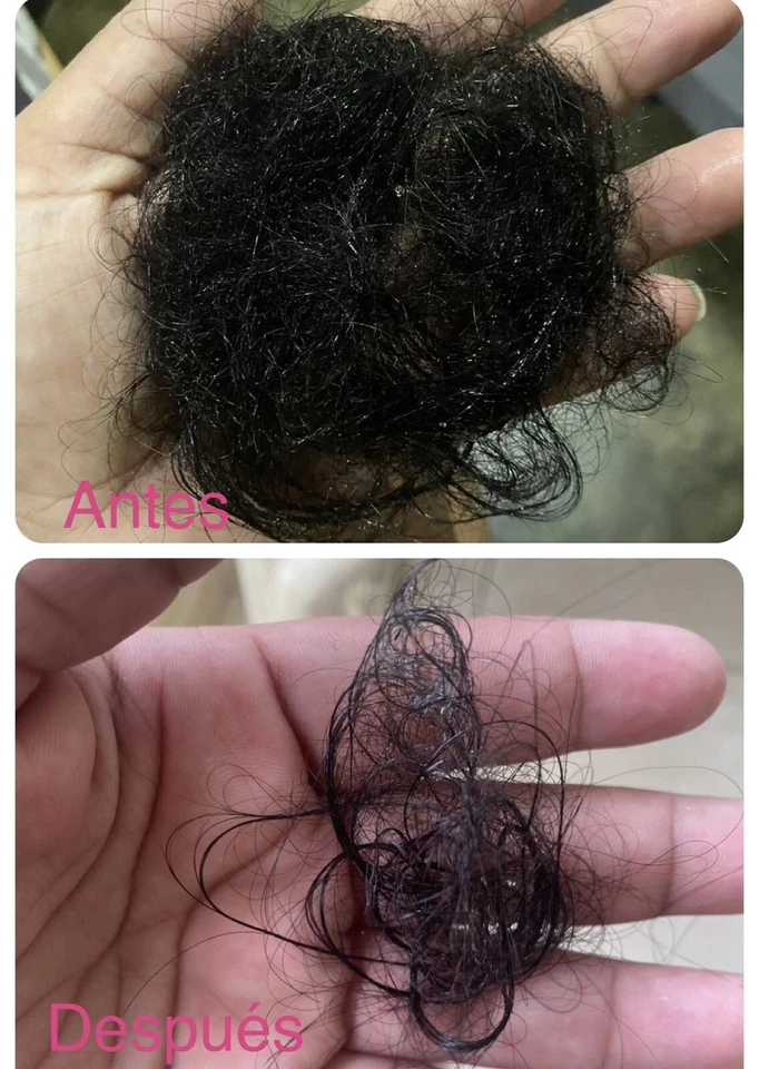 Gotero/tónico capilar control caída y crecimiento - Image 3 of 4